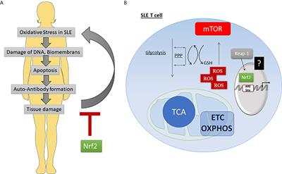 Oxidative Stress in SLE T Cells, Is NRF2 Really the Target to Treat?